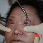 Chinese woman in morgue