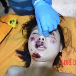 Fall from building killed her and tore off her leg