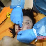 Fall from building killed her and tore off her leg