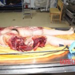 Fall from building killed her and tore off her leg