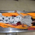 Fall from building killed her and tore off her leg