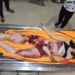 Fall from building killed her and tore off her leg