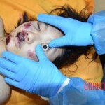 Fall from building killed her and tore off her leg
