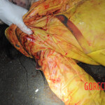 Initial examination of dead Chinese woman