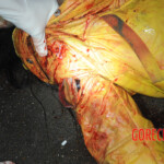 Initial examination of dead Chinese woman