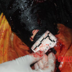 Initial examination of dead Chinese woman