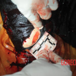 Initial examination of dead Chinese woman