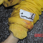 Initial examination of dead Chinese woman