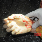 Initial examination of dead Chinese woman