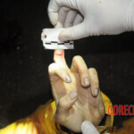 Initial examination of dead Chinese woman
