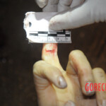 Initial examination of dead Chinese woman