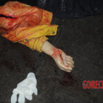 Initial examination of dead Chinese woman