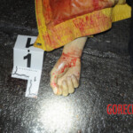 Initial examination of dead Chinese woman