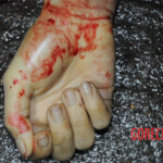 Initial examination of dead Chinese woman