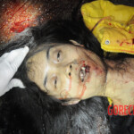 Initial examination of dead Chinese woman