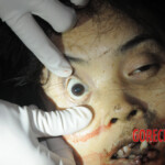 Initial examination of dead Chinese woman