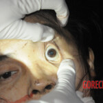 Initial examination of dead Chinese woman