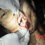 Initial examination of dead Chinese woman