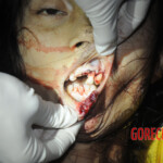 Initial examination of dead Chinese woman