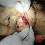 Initial examination of dead Chinese woman