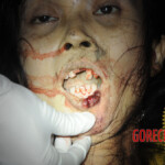 Initial examination of dead Chinese woman
