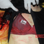 Initial examination of dead Chinese woman