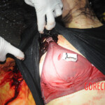 Initial examination of dead Chinese woman