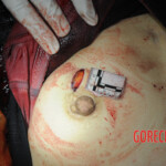 Initial examination of dead Chinese woman