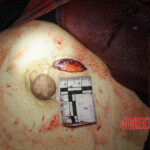 Initial examination of dead Chinese woman