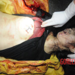 Initial examination of dead Chinese woman