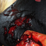 Initial examination of dead Chinese woman