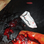 Initial examination of dead Chinese woman