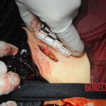 Initial examination of dead Chinese woman