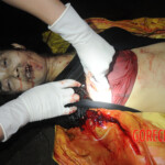 Initial examination of dead Chinese woman