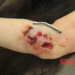 Initial examination of female suicide victim