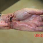 Initial examination of female suicide victim