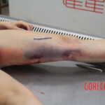 Initial examination of female suicide victim