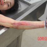 Initial examination of female suicide victim