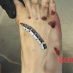 Initial examination of female suicide victim