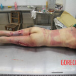 Initial examination of female suicide victim