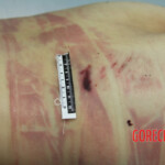 Initial examination of female suicide victim