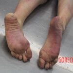 Initial examination of female suicide victim