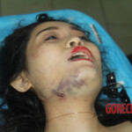 Initial examination of female suicide victim