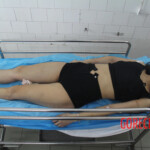 Initial examination of female suicide victim