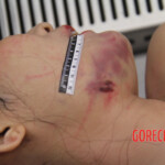 Initial examination of female suicide victim