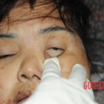 Initial examination of hanged Chinese woman