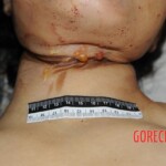 Initial examination of hanged Chinese woman