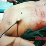 MIX: Victims of Papuan tribal wars