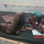 MIX: Victims of Papuan tribal wars