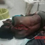 MIX: Victims of Papuan tribal wars